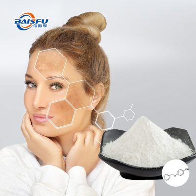 Monobenzone as a Skin Depigmenting Agent for the Treatment of Hyperpigmentation